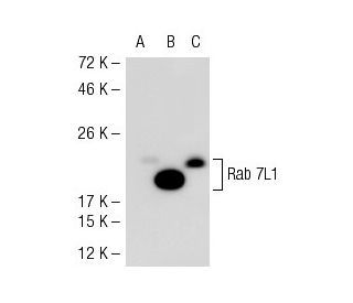Rab 7L1 Antibody (31-E) - Western Blotting - Image 52106