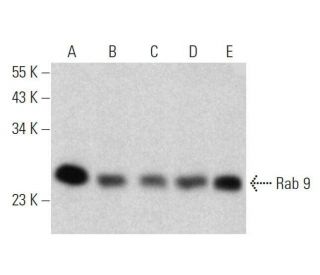 Rab 9 Antibody (G-5) - Western Blotting - Image 358614 