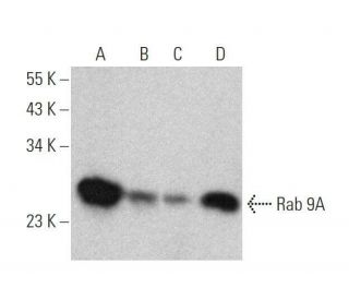 Rab 9A Antibody (6D717) - Western Blotting - Image 358613 