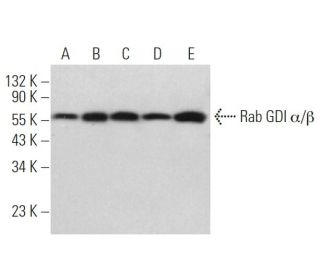 Rab GDI α/β Antibody (E-5) - Western Blotting - Image 371641Each CRISPR/Cas9 Knockout (KO) Plasmid product consists of a pool of 3 plasmids designed to ensure identification and cleavage of a specific gene for maximum knockout efficiency. Each plasmid encodes a unique 20 nt sequence derived from the GeCKO (v2) library.