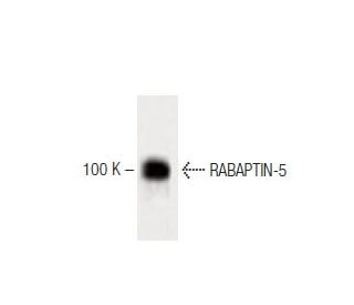 RABAPTIN-5 Antibody (20) - Western Blotting - Image 60426 