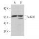 Rad23B Antibody (F-8) - Western Blotting - Image 363752