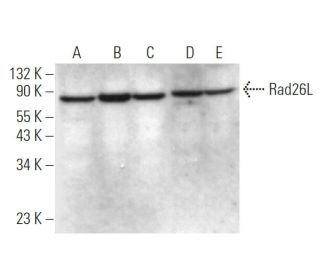 Rad26L Antibody (B-11) - Western Blotting - Image 374842 
