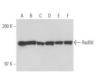 Rad50 Antibody (13B3/2C6) - Western Blotting - Image 17084 