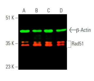 Rad51 Antibody (3C10) - Western Blotting - Image 370541 