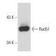 Rad51 Antibody (51RAD01) - Western Blotting - Image 18132