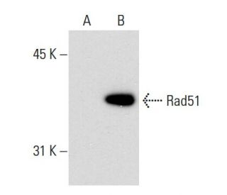 Rad51 Antibody (51RAD01) - Western Blotting - Image 53034 