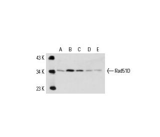 Rad51D Antibody (5B3/6) - Western Blotting - Image 14735 