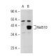 Rad51D Antibody (5B3/6) - Western Blotting - Image 72832