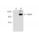Rad54 Antibody (A-4) - Western Blotting - Image 72950 
