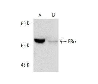 ER&alpha; (D-12): sc-8005. Western blot analysis of ER&alpha; expression in untreated (A) and Radicicol (sc-200620) treated (B) MCF7 w 