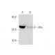 ERα (D-12): sc-8005. Western blot analysis of ERα expression in untreated (A) and Radicicol (sc-200620) treated (B) MCF7 w 