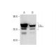ERα (H226): sc-53493. Western blot analysis of ERα expression in untreated (A) and Radicicol (sc-200620) treated (B) MCF7