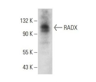 RADX Antibody (A-3) - Western Blotting - Image 324766SAM Transcription Activation: SAM system utilizing dCas9-VP64, MS2-P65-HSF1, and sgRNA for precise gene transcription activation.