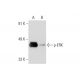 p-ERK (E-4): sc-7383. Western blot analysis of ERK phosphorylation in untreated (A) and Raf Kinase Inhibitor V (sc-222241) 