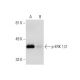 Raf Kinase Inhibitor V: sc-222241. Western blot analysis of ERK 1/2 phosphorylation in untreated (A) and Raf Kinase Inhibi