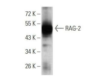 RAG-2 Antibody (4D5C7) - Western Blotting - Image 358252