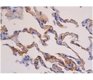 RAGE Antibody (9A11) - Immunohistochemistry - Image 353618 