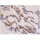 RAGE Antibody (9A11) - Immunohistochemistry - Image 353618 