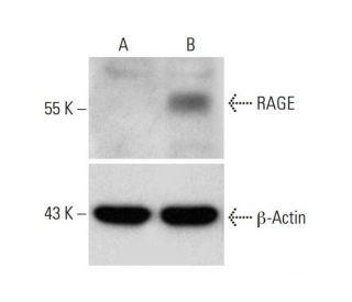 RAGE CRISPR Activation Plasmid (h): sc-400284-ACT. Western blot analysis of... 