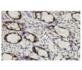 Ral B Antibody (XY-12) - Immunohistochemistry - Image 35936 