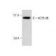 ACTR-IIB Antibody (G-7) - Western Blotting - Image 283572
