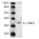 Ramos + IL-4 Cell Lysate: sc-24762. Western blot analysis of... 