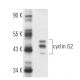 Ramos + IL-4 Cell Lysate: sc-24762. Western blot analysis of...