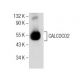 Ramos nuclear extract: sc-2153. Western blot analysis of CALCOCO2 expression... 