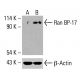 Ran BP-17 抗体 (B-1):sc-518249。未经处理(A)和经化学处理(B)的HCT-116全细胞裂解液中Ran BP-17表达的Western blot分析。所用检测试剂:m-IgG1 BP-HRP:sc-525408。β-肌动蛋白(C4):sc -47778 用作内参。所用检测试剂:m-IgG Fc BP-HRP:sc-525409。 Ran BP-17 Antibody (B-1) - Western Blotting - Image 416498