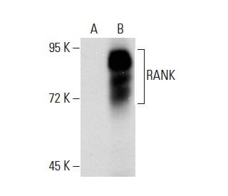 RANK Antibody (64C1385.1) - Western Blotting - Image 53046