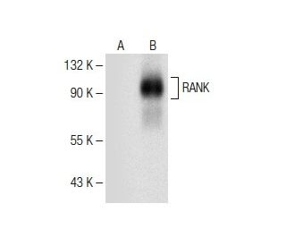 RANK Antibody (H-7) - Western Blotting - Image 150173 
