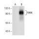 RANK Antibody (H-7) - Western Blotting - Image 150173 