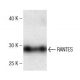 RANTES Antibody (5) - Western Blotting - Image 136726