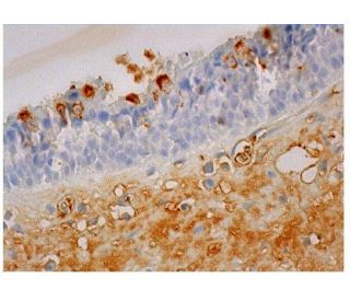 RANTES Antibody (A-4) - Immunohistochemistry - Image 350195 