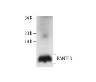RANTES Antibody (C-12) - Western Blotting - Image 296262 