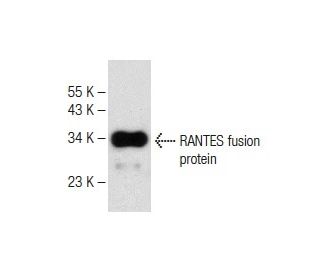 RANTES Antibody (E-2) - Western Blotting - Image 147716