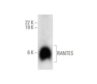 RANTES Antibody (F-11) - Western Blotting - Image 314170