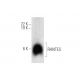 RANTES Antibody (F-11) - Western Blotting - Image 314170