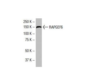 RAPGEF6 Antibody (BA-17) - Western Blotting - Image 33570 