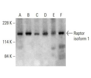 Raptor Antibody (10E10) - Western Blotting - Image 385707 