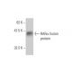 RARα/Retinoic Acid Receptor α Antibody (1C10) - Western Blotting - Image 348579
