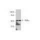 RARα/Retinoic Acid Receptor α Antibody (1C10) - Western Blotting - Image 352133 