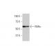 RARα/Retinoic Acid Receptor α Antibody (1C10) - Western Blotting - Image 352134 
