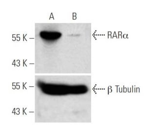 RAR&alpha; siRNA (h): sc-29465. Western blot analysis of RAR&alpha; expression in non-transfected control (A) and RAR&alph 