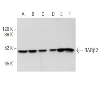 RAR&beta;/Retinoic Acid Receptor &beta; Antibody (B-12) - Western Blotting - Image 354873 