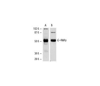 RAR&gamma;/Retinoic Acid Receptor &gamma; Antibody (G-1) - Western Blotting - Image 1756 
