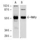 RARγ/Retinoic Acid Receptor γ Antibody (G-1) - Western Blotting - Image 1756 