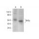 RARγ/Retinoic Acid Receptor γ Antibody (G-1) - Western Blotting - Image 379709