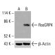 抗体 MRP-L44 (G-12):sc-515503。通过蛋白质印迹分析 HeLa (A)、K-562 (B) 和 HCT-116 (C) 完整细胞裂解物中 MRP-L44 的表达。使用的检测试剂:m-IgG Fc BP-HRP:sc-525409。 RasGRP4 Antibody (E-2) - Western Blotting - Image 416029